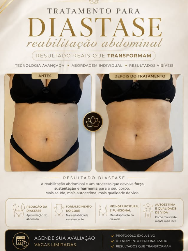 Registro de evolução no acompanhamento da diástase abdominal